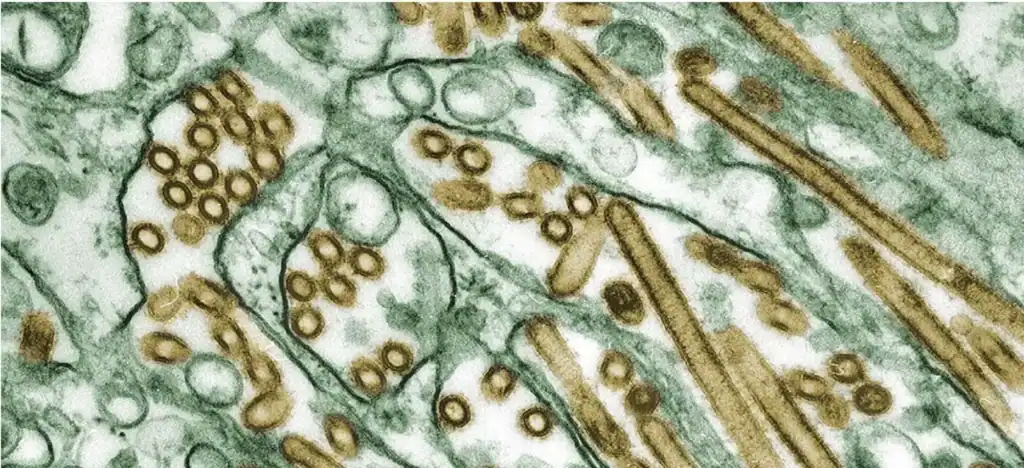 img Transmission electron microscope image showing avian influenza (bird flu) virus particles within infected tissue cells at high magnification.